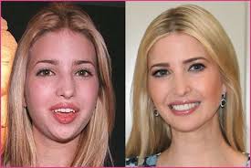 Pics Of Ivanka Trump Before Plastic Surgery Plastic Surgery Plastic Surgery Before And After Celebrity Plastic Surgery Plastic Surgery Photos Plastic Surgery