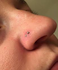 Der discountshop für coole piercings und angesagten schmuck. Swollen Nose Piercing Causes Treatment Authoritytattoo