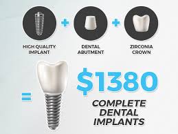 We have slashed the price of our dental implants dramatically for residents in and around the greater houston area. Cost Of Dental Implants Atlantic Dental Group