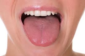 Blisters on the tongue may be canker sores or symptoms of a range of conditions. Dentalfeature What Causes A Swollen Tongue Caribbean News