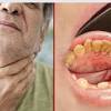 How can you test for oral cancer at home? 1