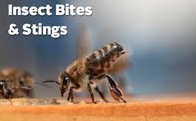 Black And White Insect With Stinger Qa On Insect Bites And Stings Insect Bites And Stings Bee Sting