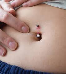 Image result for svrab na k%u016F%u017Ei