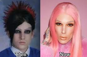 Jeffree star got his start in music and beauty on myspace in 2006. Plastic Surgery On Strikingly