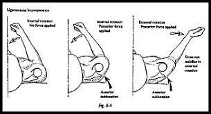 Check spelling or type a new query. Examination Under Anaesthesia Shoulderdoc