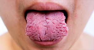 This video covers a tongue twister warm up. Pictures What Your Tongue Says About Your Health