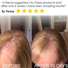 The enzymes help in preventing the loss of hair and enhance the circulation of hemoglobin to the cells and the follicles of the hair. Biotin Vitamin Shampoo Conditioner Set For Hair Loss Sulfate Free With Aloe Vera Cucumber B The Product Walmart Com Walmart Com