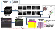 Hypoechoic means an area looks darker on ultrasound than the that usually means cancer. Automated Assessment Of Breast Cancer Margin In Optical Coherence Tomography Images Via Pretrained Convolutional Neural Network Singla 2019 Journal Of Biophotonics Wiley Online Library