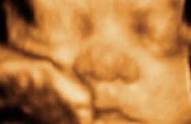 3d/4d ultrasound our goal is to make your experience one not to forget by offering the lowest prices on 3d 4d ultrasound in brooklyn, queens, bronx, staten island. 1st Glimpse Inc 3d 4d Ultrasound 2769 Coney Island Ave Brooklyn Ny 11235 Yp Com