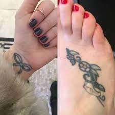 This is our online appointment page. My Experience With Laser Tattoo Removal In Nyc Before After