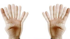 For example, a person may. Tremor Ms Trust