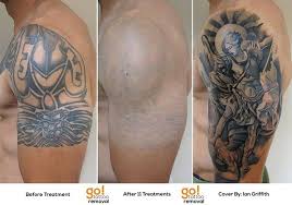 The artist adds a background of green leaves in a faded manner. Last Weekend We Shared The Progress Achieved With This Client S Half Sleeve Removal This Is What Is Possible When Laser Tattoo Removal Tattoo Removal Tattoos