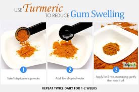 Home Remedies To Reduce Gum Swelling Top 10 Home Remedies Swollen Gum Swollen Gums Remedy Gum Inflammation