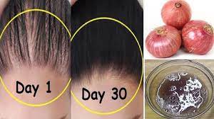 This foam formula is perfect for the early stages of hair loss and is supposed to regrow up to 25 percent more hair. How To Grow Long Stop Hair Fall With Onion Egg Magical Hair Growth T Hair Growth Treatment Hair Loss Treatment How To Grow Natural Hair