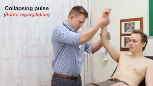 Image result for Collapsing Pulse