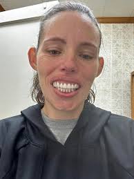 I had my teeth removed with oral sedation ! I was told to put my teeth in  45 mins later and they didn't fit so we went back and they tried to