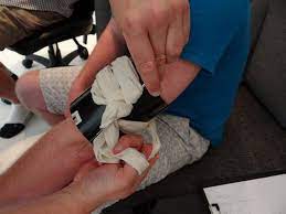 When applied for a longer time, tourniquets can cause permanent damage to muscles, nerves, and blood vessels. The Truth About Tourniquets When And How To Use A Tourniquet
