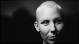 It helps to know that hair grows back, and you can take steps to make its loss less of problem for you. Hair Loss Chemotherapy Why It Happens What To Expect During Cancer Treatment Latestly