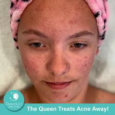 Tamara's Skin Care Clinic (tamarasskincare)