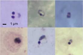 Infection by plasmodium falciparum—the parasite responsible for malaria in humans—can result in a severe disease that can be fatal or in an uncomplicated disease that can be resolved by the host immune system. Ring Form P Falciparum Malaria Parasites Download Scientific Diagram