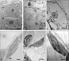 Maybe you would like to learn more about one of these? Ultrastructure Of Root And Leaf Cells Root Cells From A Control Plant Download Scientific Diagram
