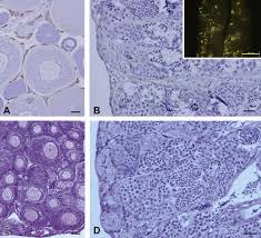 Check spelling or type a new query. Gonadal Soma Derived Factor Gsdf A Tgf Beta Superfamily Gene Induces Testis Differentiation In The Teleost Fish Oreochromis Niloticus Sciencedirect