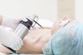 Image result for Cryotherapy