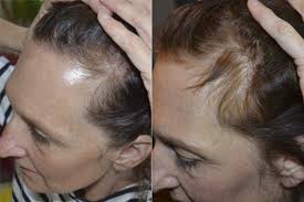 Marilyn Cormier (cormier0064)