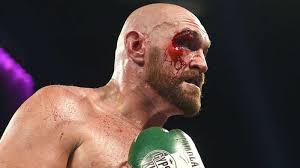 Get latest tyson fury news including stats, record, training and injury updates plus gypsy king's next fight and more here. Tyson Fury Tweet Hints At Three Day Deadline To Agree Anthony Joshua Fight Dazn News Germany