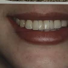 The Systematic Treatment Of A Canted Smile - Oral Health Group