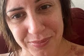 Fundraiser by Molle Kabodian : Support for Katie