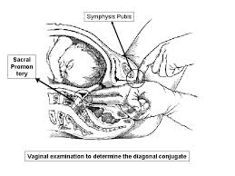 Maybe you would like to learn more about one of these? Abnormal Labour And It Management Definitions Stages And