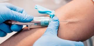 Try to remember, you always have to care for your child with amazing care, compassion and affection to be able to help him learn. National Healthcare Association Phlebotomy Certification Practice Test Proprofs Quiz