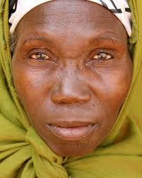 Spaces of Waiting: Obstetric Fistula in Niger