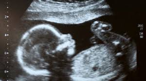 Dein baby zeigt ab dem zweiten lebensmonat keine reaktion, wenn es deine stimme hört. 15 Ssw Schwangerschaftswoche Grosse Entwicklung 9monate De
