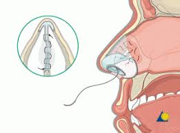 Image result for Nasal Packing