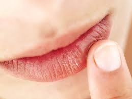 Senales De Que Tus Labios Resecos Podrian Ser Un Problema Grave