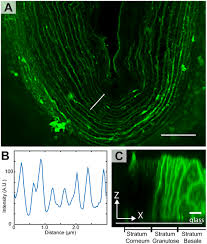 13 photos of the labelled diagram of a human skin. Superresolution And Fluorescence Dynamics Evidence Reveal That Intact Liposomes Do Not Cross The Human Skin Barrier
