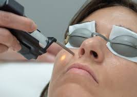 2020 popular laser epilation trends in home appliances, epilators, beauty & health, hair removal cream with laser epilation and laser epilation. Clmo Centre Laser Lyon Epilation Definitive Au Laser Lyon