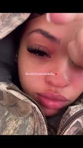 Golora Ole Kamo Gara Accident