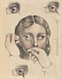 details about vintage eye anatomy surgery medical chart painting 8x10 real canvas art print