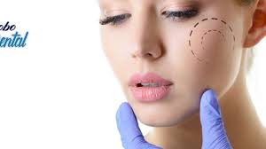 Bichectomia é o procedimento médico que tem por objetivo a redução da circunferência facial. Bichectomia Y Liposuccion De Papada Clinica Dental En Guatemala