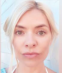 Has Holly Willoughby Had Botox or Fillers?