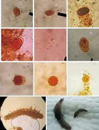 Parasites In Vegetables A T Trichiura Whipworm Egg B G Download Scientific Diagram