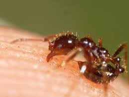 Image result for Fire Ant Sting