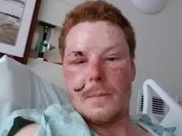 Fundraiser for John Leece by Jazzee Leece : Fundraising for John Leece  accident