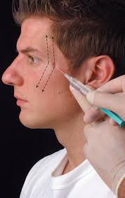 Image result for Ear Nerve Block