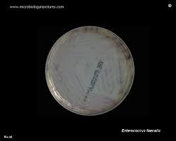 Image result for Vancomycin Resistant Enterococcus