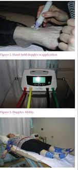 Figure 3 From Evaluation Of An Automated Ankle Brachial
