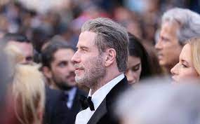 Ricorrono alle nuove tecniche di trapianto capelli non solo attori e cantanti ma anche famosi politici. Trapianto Capelli Vip Ecco I Casi Piu Noti Bio Hair Clinic